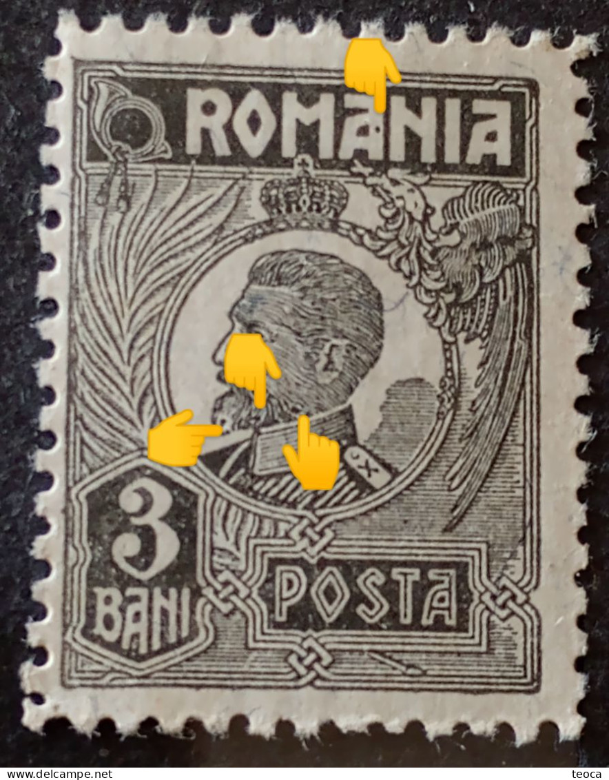 Errors Romania 1920 King Ferdinand Printed With 3 Circles On Beard Variety Errors Unused Gumn - Variedades Y Curiosidades