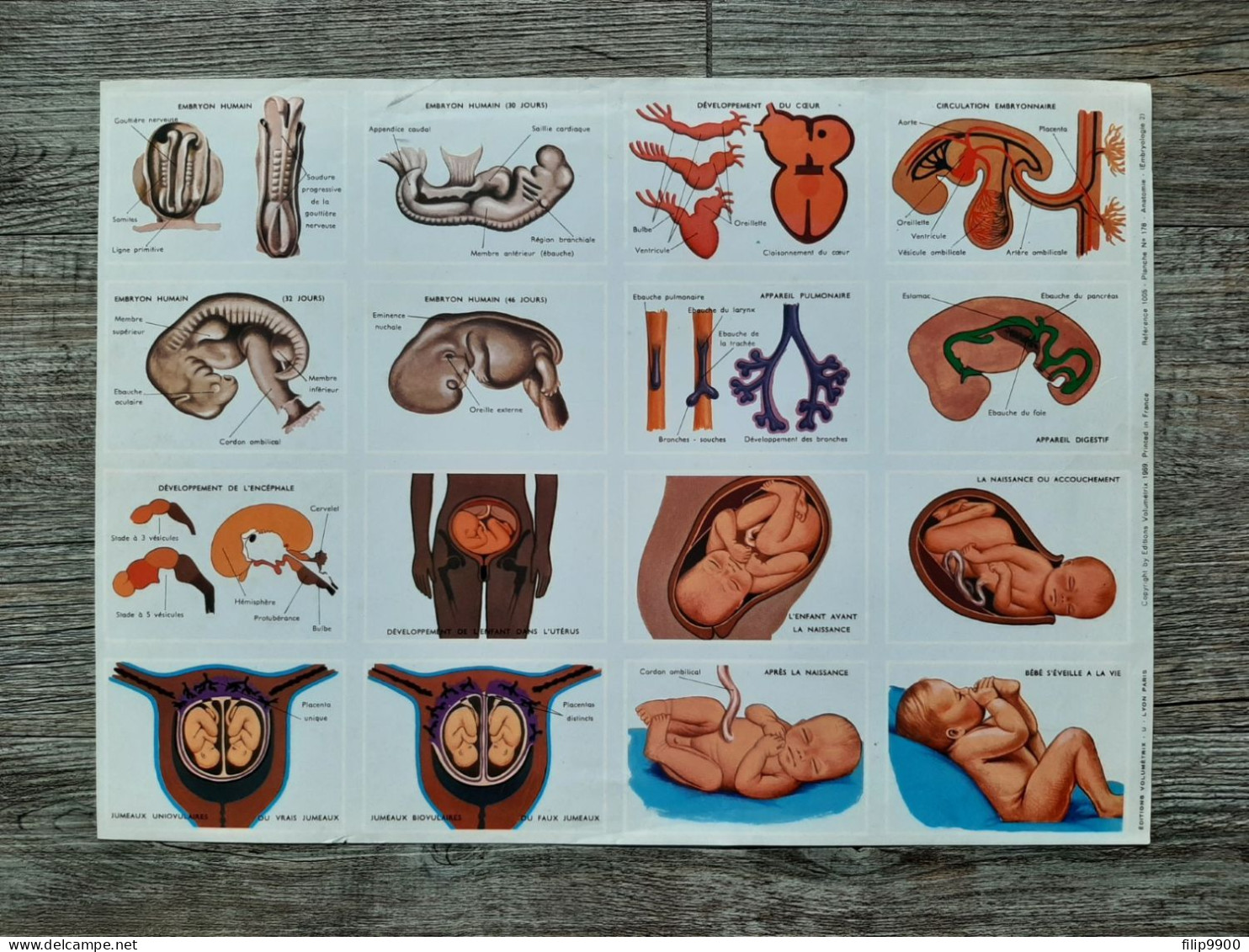 Editions Volumétrix Réf. 1005 - Planche N° 178 - Anatomie (Embryologie 2) (1969) - 23x32cm - Fichas Didácticas