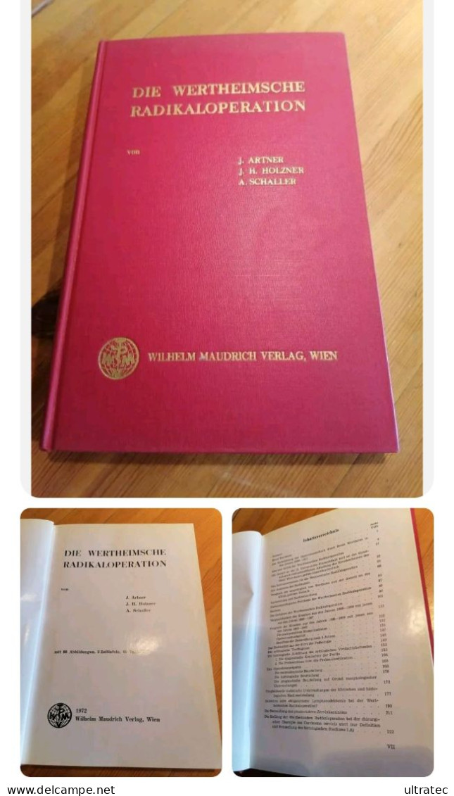 DIE WERTHEIMSCHE RADIKALOPERATION Josef Artner (Autor)  Buch Gynäkologie - Santé & Médecine