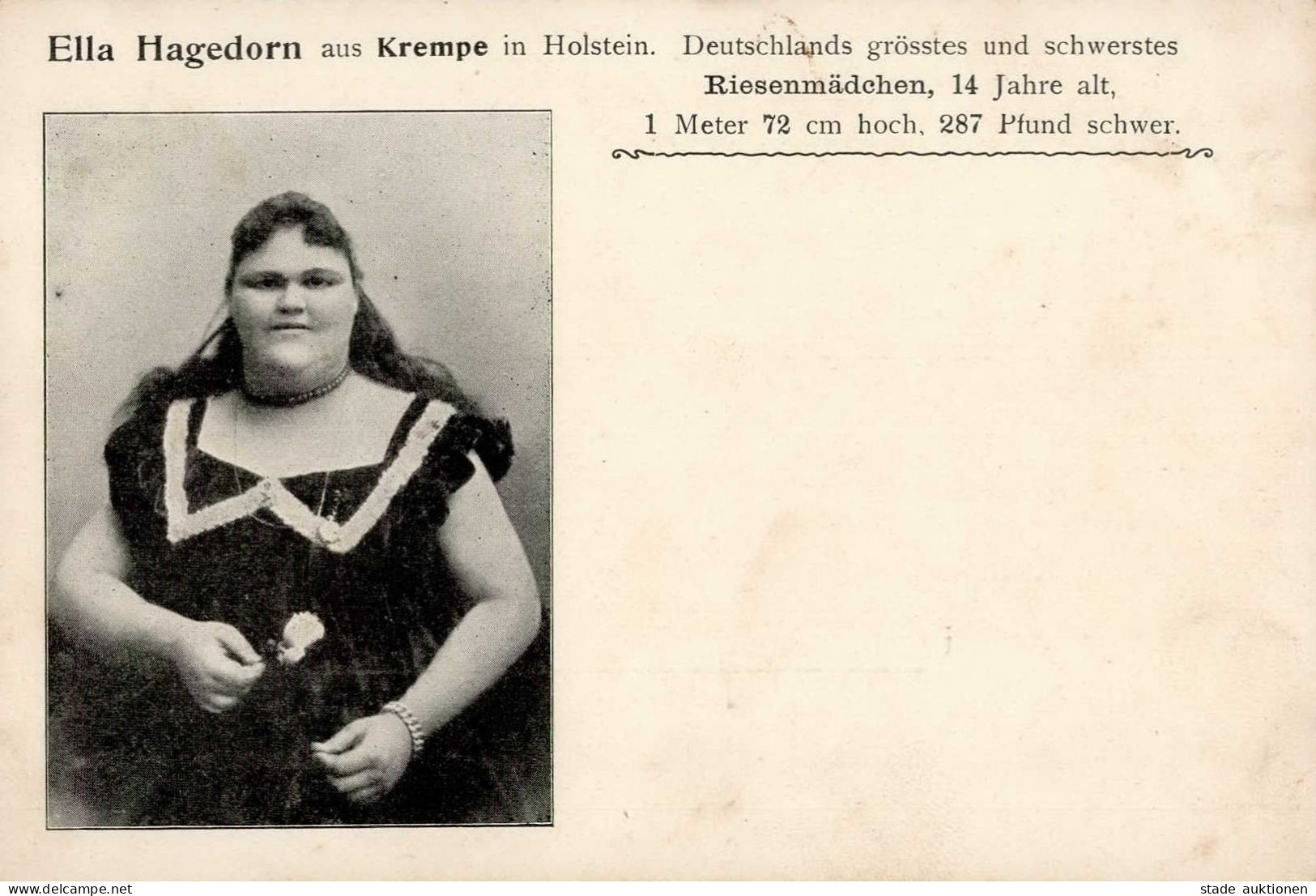 Zirkus Riesenmädchen Ella Hagedorn Aus Krempe I-II (Eckbug) - Cirque