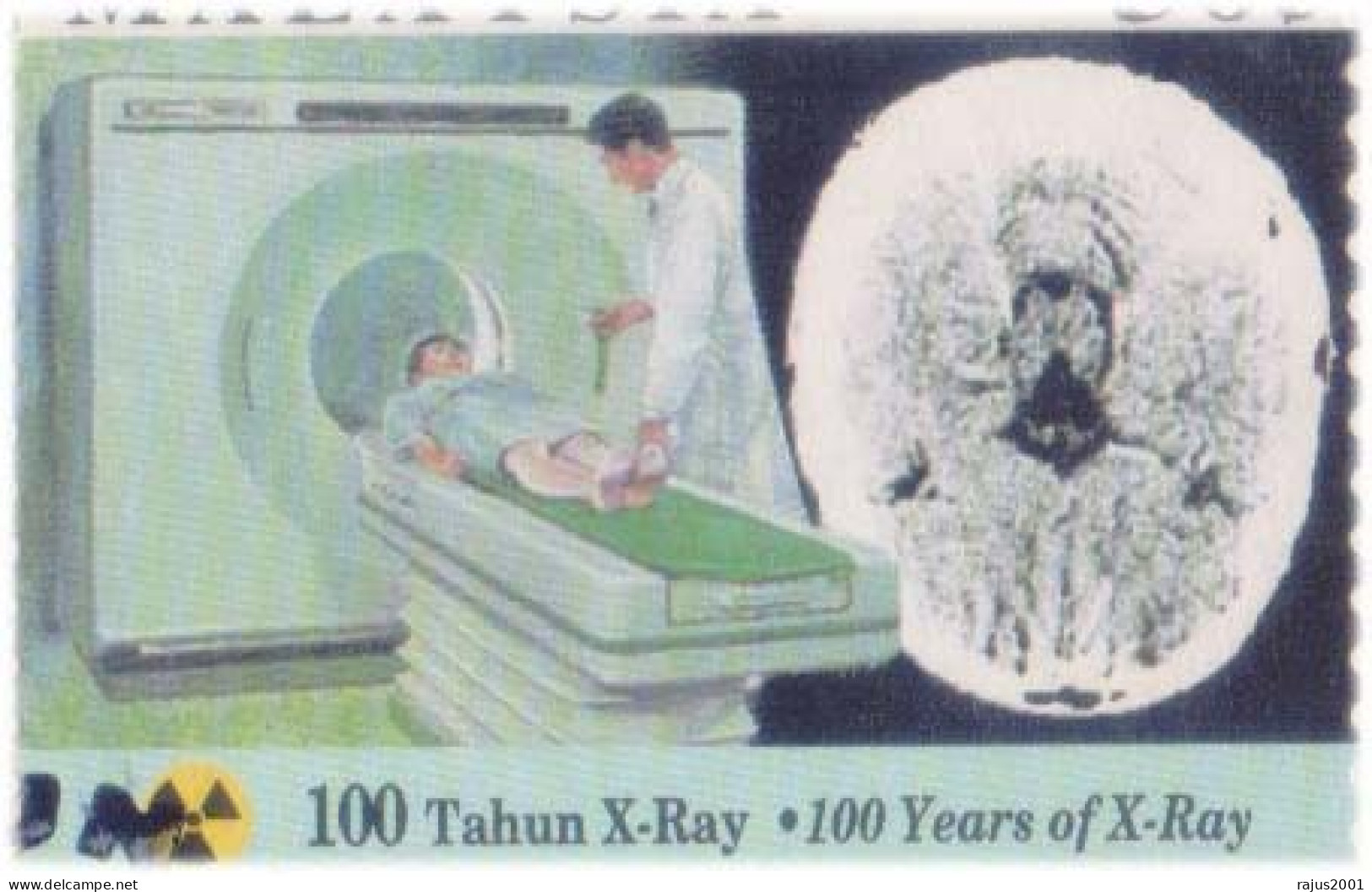 X Ray, Computed Tomography CT Scanner, Cat Scan, Hand Made X-Ray Machine, Science, Bone, Lungs, Skull, XRay Malaysia FDC - Médecine