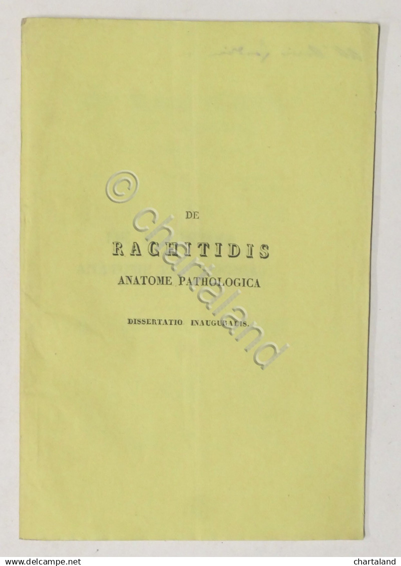 De Rachitidis Anatome Pathologica - Dissertazione Laurea Università Pavia - 1843 - Altri & Non Classificati