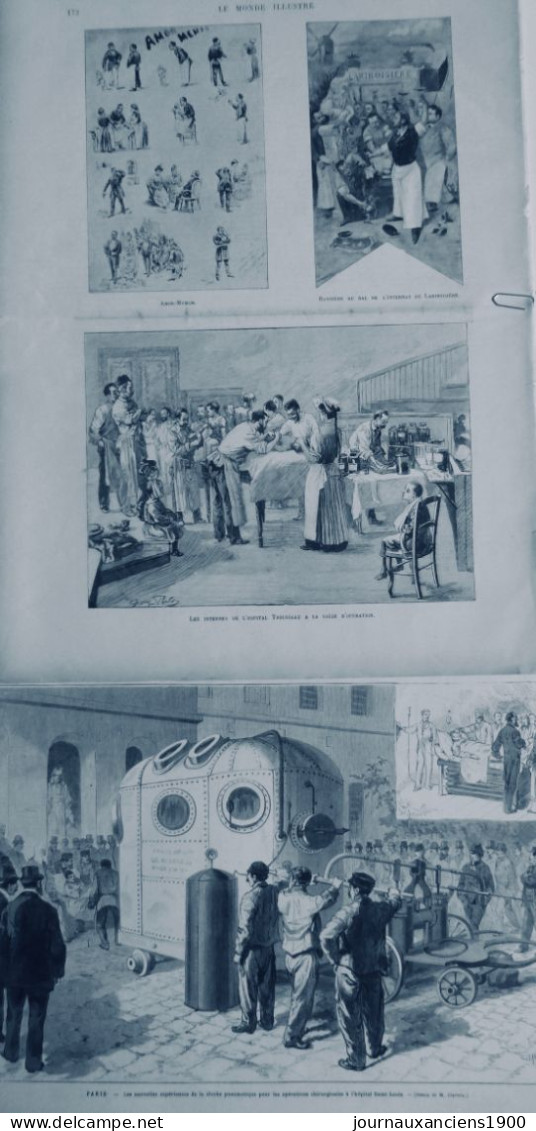 1893 CHIRURGIE OPERATION HOP TROUSSEAU CLOCHE AIR COMPRIME PEAN 2 JOURNAUX ANCIENS - Ohne Zuordnung