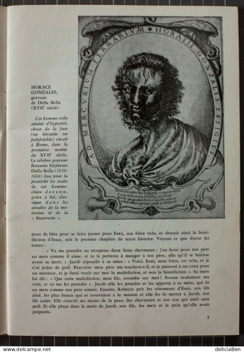 Æsculape, Revue Mensuelle Illustrée Mai-Juin 1961 : LES VELUS ( « HOMMES-CHIENS »et « FEMMES A BARBE » De Jean BOULLET - Medicina & Salud