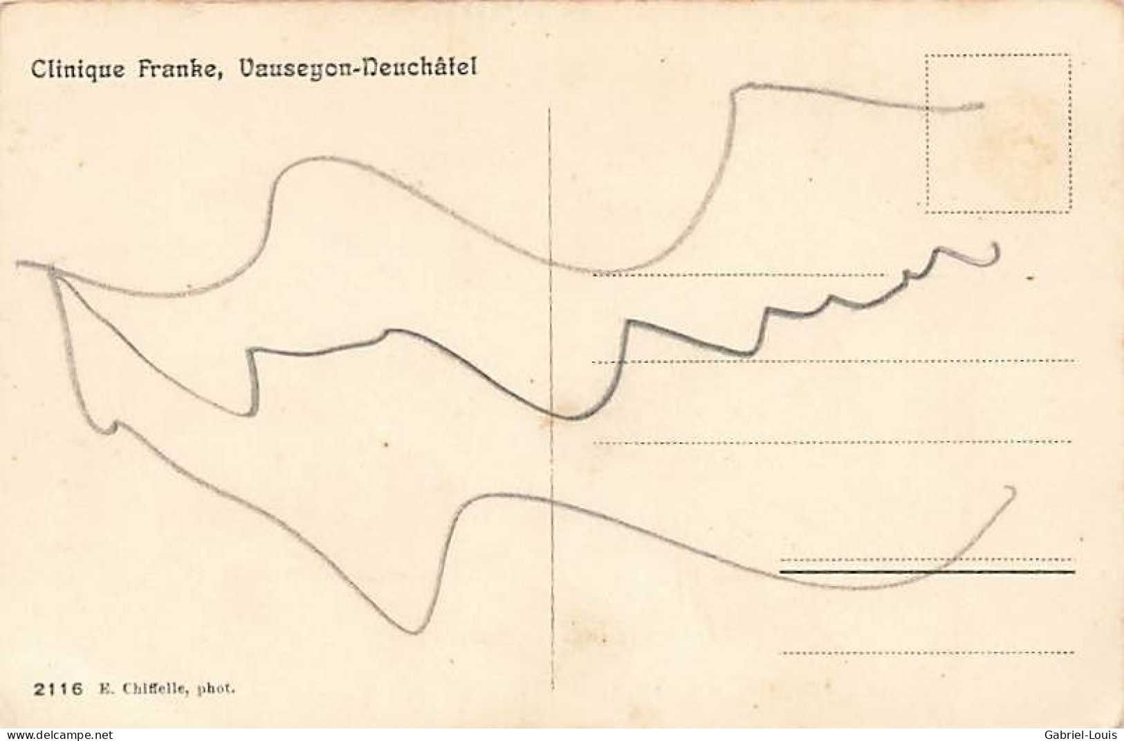 Clinique Franke Vauseyon Neuchâtel - Neuchâtel