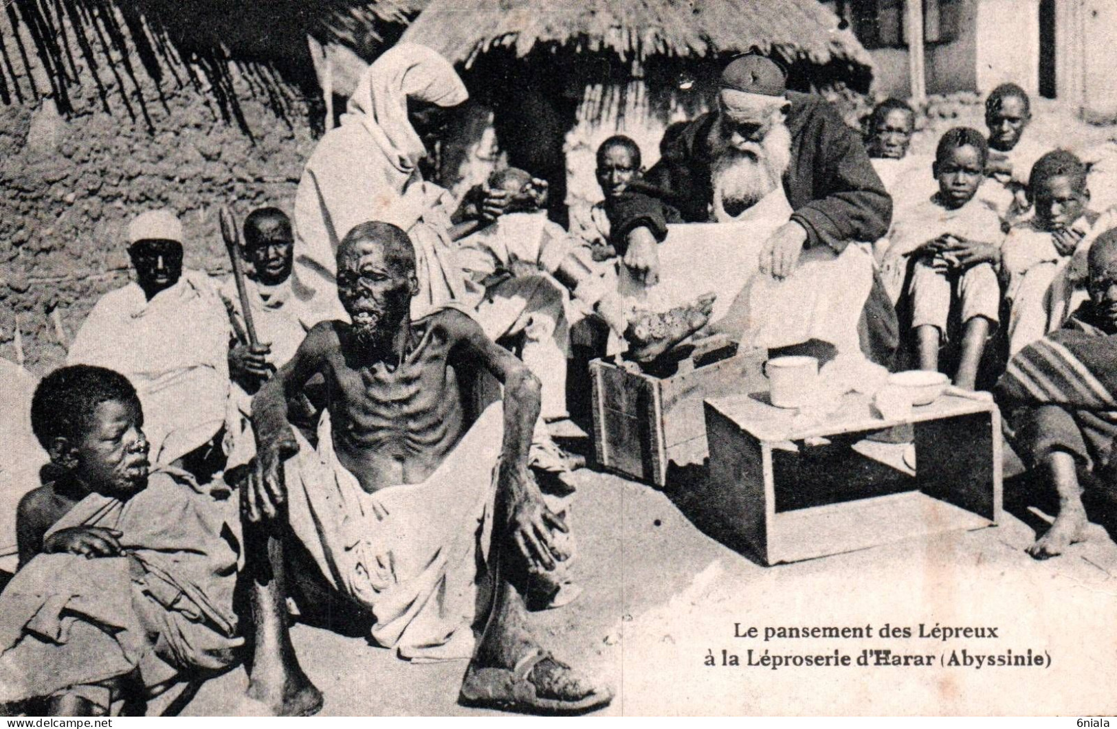 20263 Le Pansement Des Lépreux à  La Léproserie D'Harar ( Abyssinie ) ETHIOPIE   (  2 Scans) - Etiopia