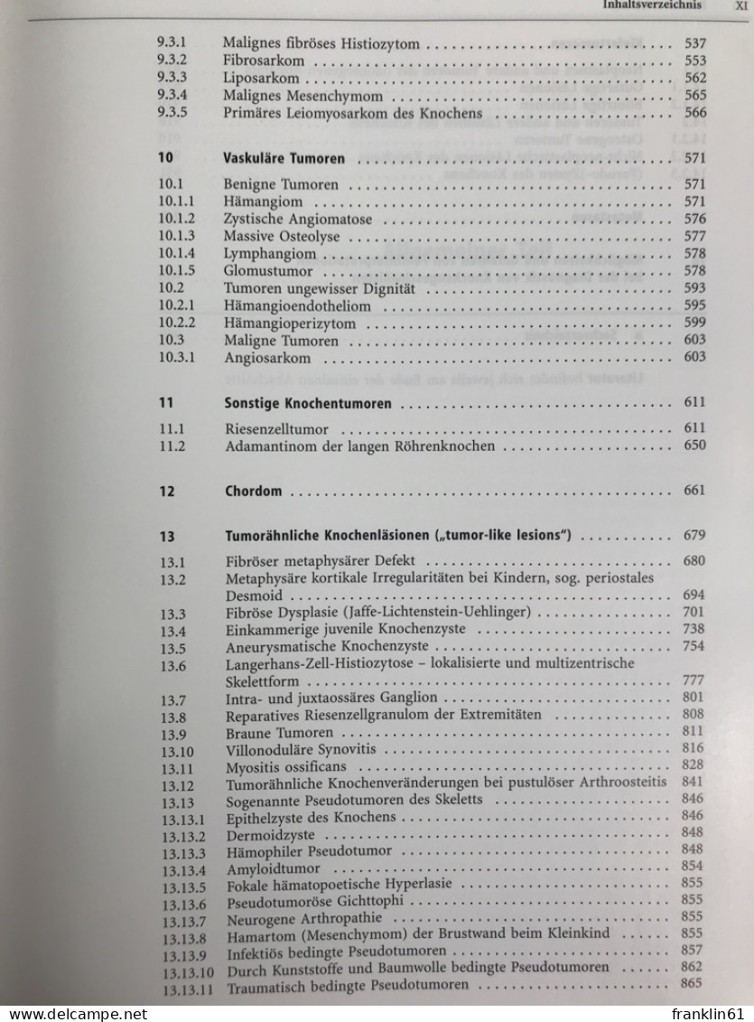 Knochentumoren : Klinik, Radiologie, Pathologie. - Santé & Médecine