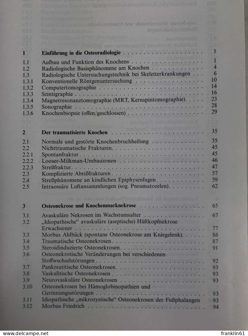 Skeletterkrankungen : Klinisch-radiologische Diagnose Und Differentialdiagnose. - Health & Medecine