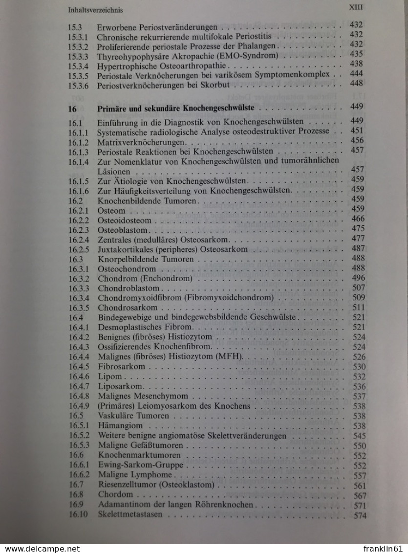 Skeletterkrankungen : Klinisch-radiologische Diagnose Und Differentialdiagnose. - Santé & Médecine