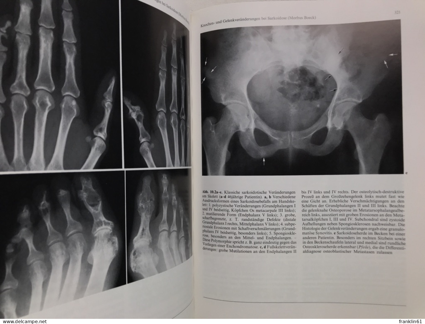 Skeletterkrankungen : klinisch-radiologische Diagnose und Differentialdiagnose.