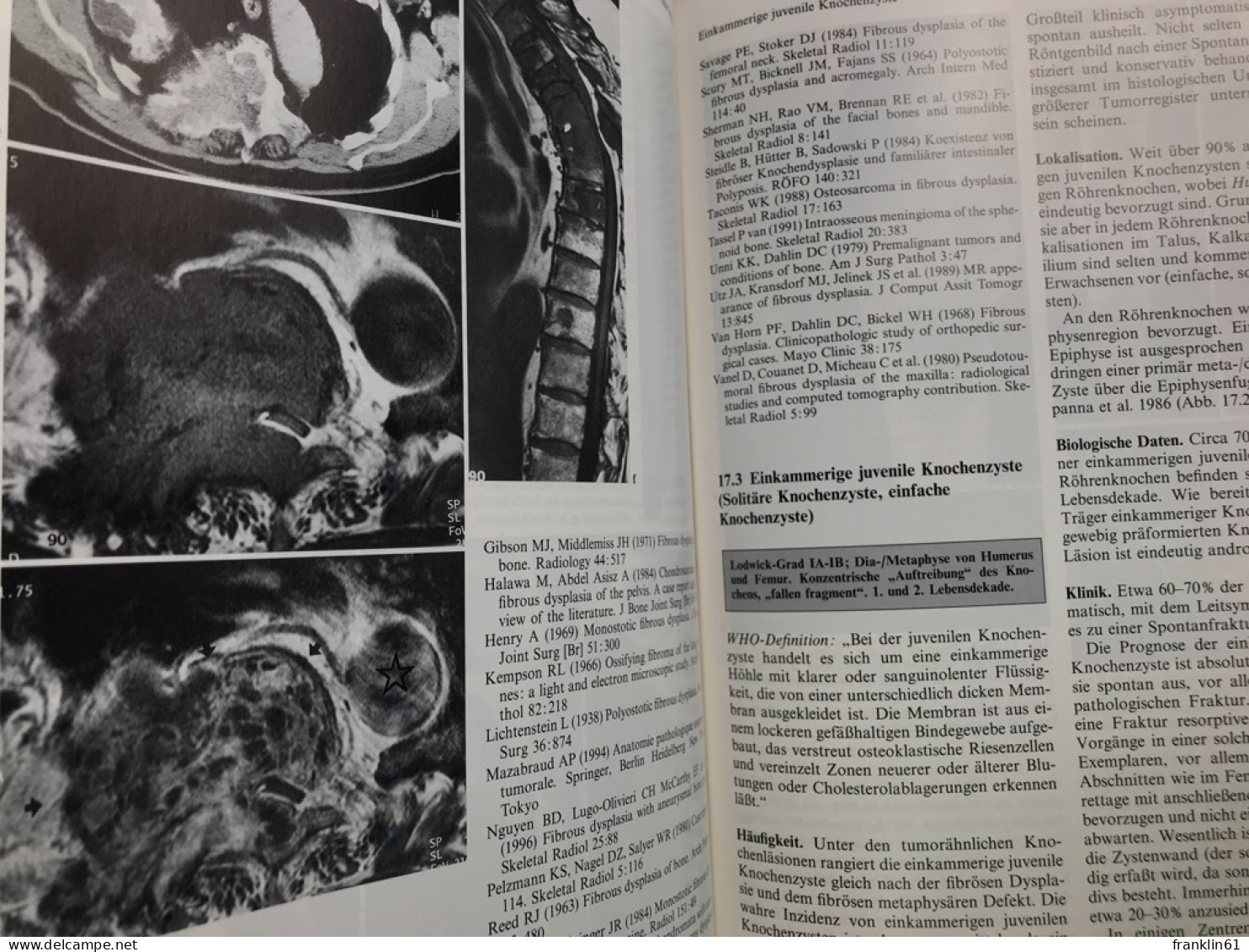 Skeletterkrankungen : klinisch-radiologische Diagnose und Differentialdiagnose.