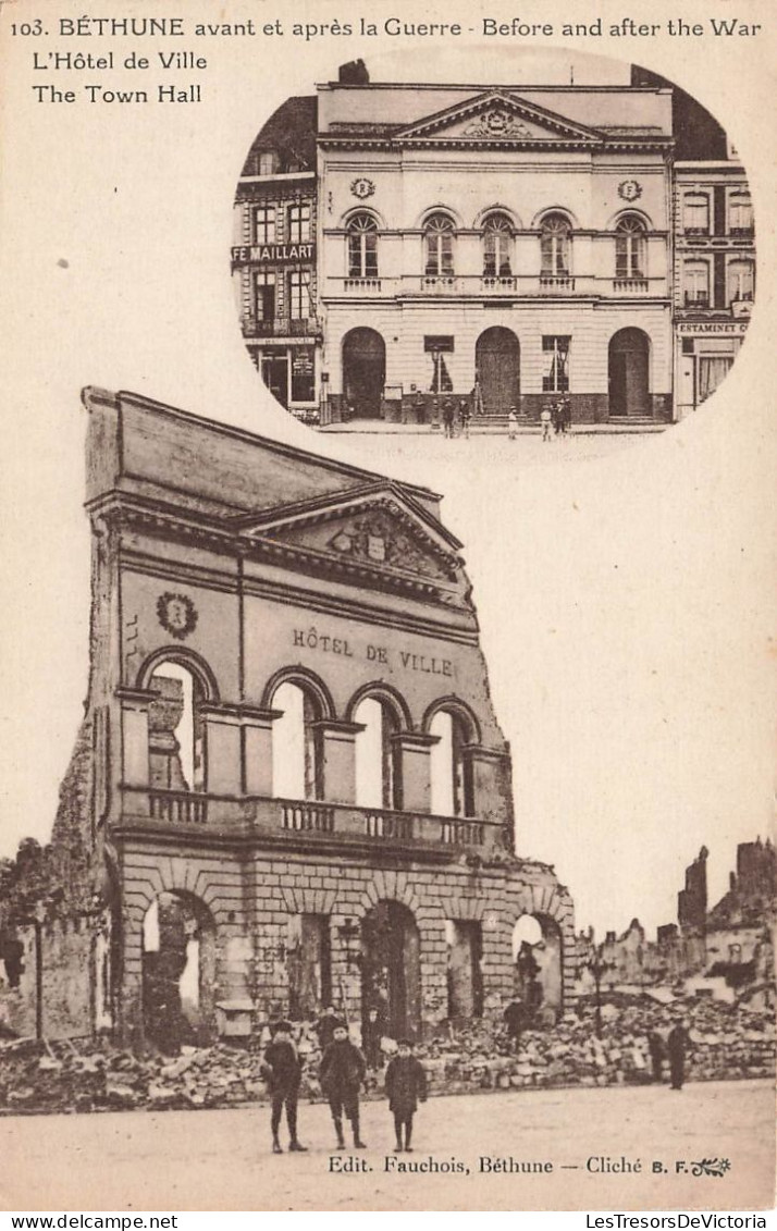 FRANCE - Béthune - L'hôtel De Ville Avant Et Après La Guerre  - Carte Postale Ancienne - Bethune