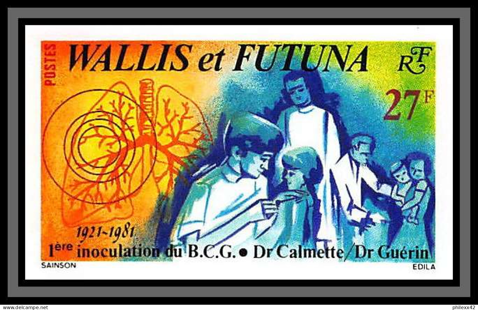 90598c Wallis Et Futuna 273 Antituberculeux Vaccin Calmette Tuberculosis Vaccine Non Dentelé Imperf MNH ** Discount - Non Dentelés, épreuves & Variétés