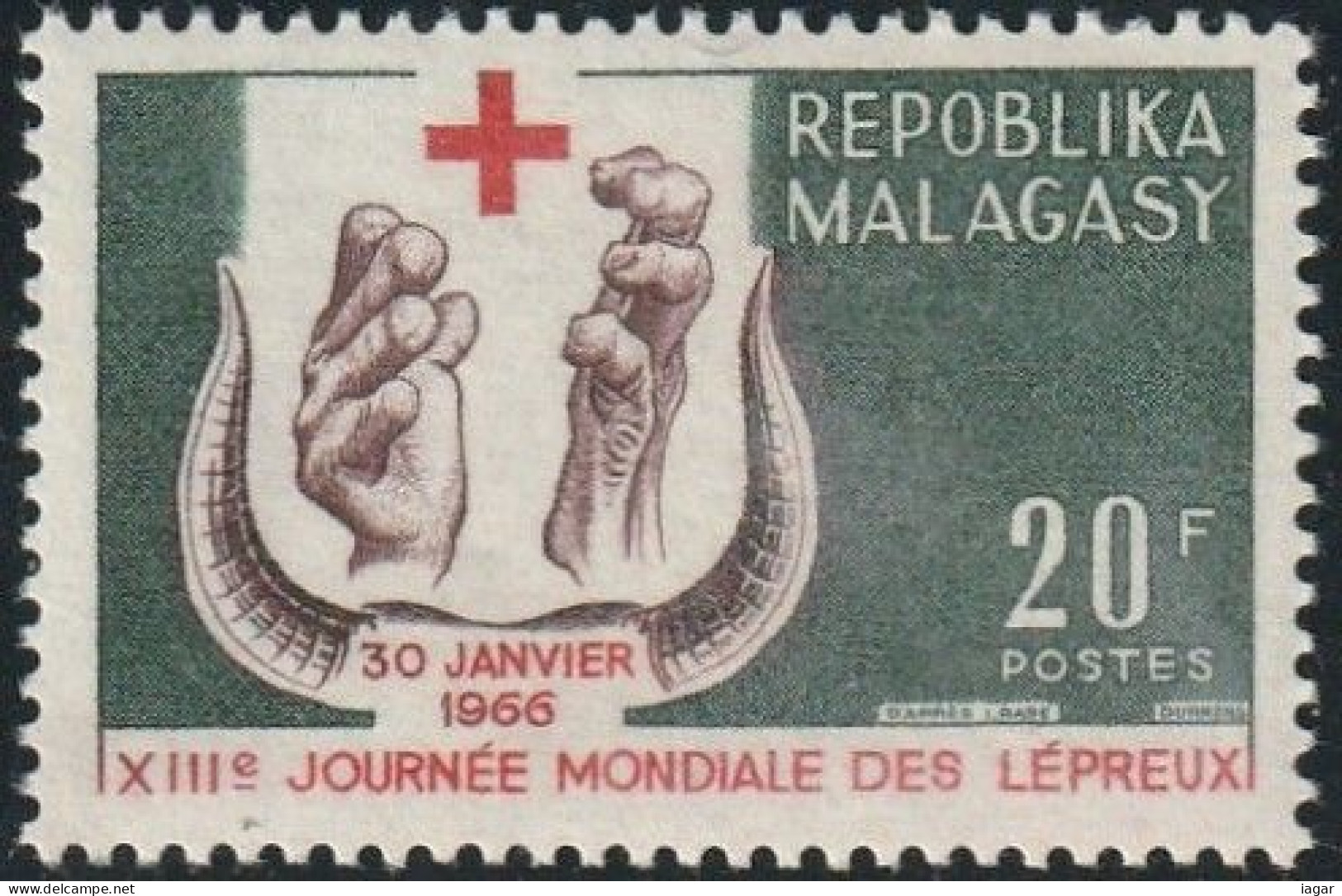 THEMATIC HEALTH:  WORLD LEPER DAY   -   MADAGASCAR - Médecine
