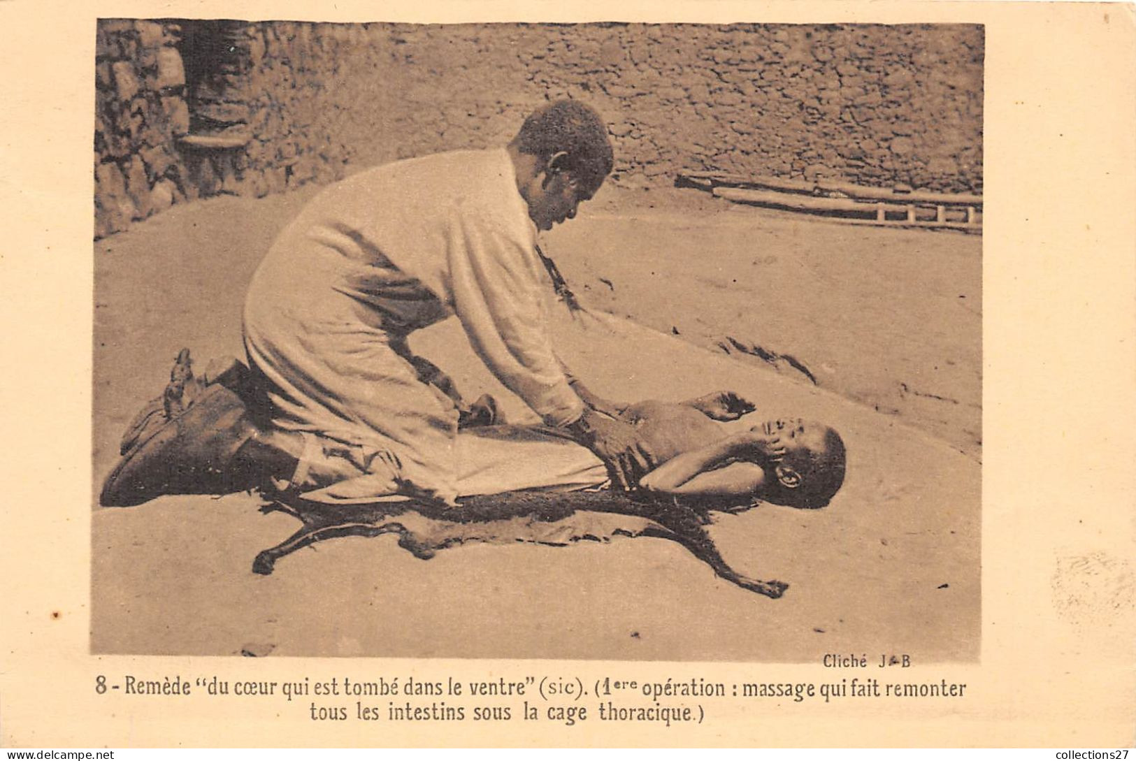 ETHIOPIE- REMEDE- DU COEUR QUI EST TOMBE DANS LE VENTRE 1ere OPERATION : MASSAGE QUI FAIT REMONTER TOUS LES INTESTINS - Äthiopien