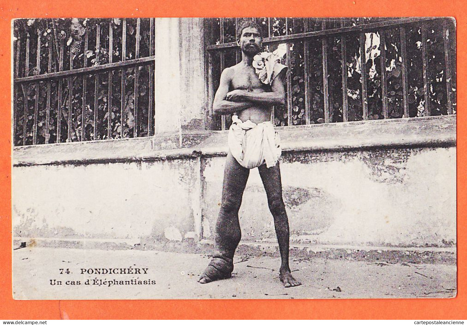 23834 / ( Etat Parfait ) PONDICHERY Comptoir Des Indes Cas D'ELEPHANTIASIS Maladie Tropicale 1900s M.M N°74 - India