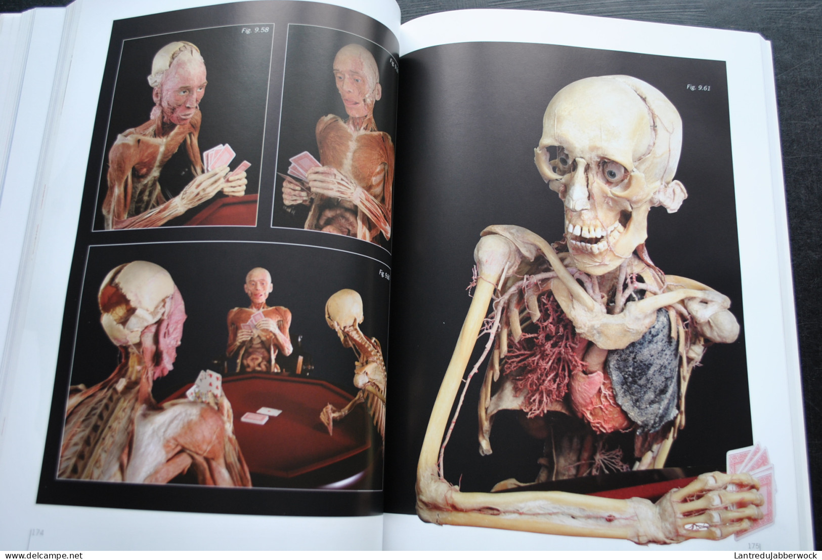 Gunther von Hagens Le monde du corps exposition anatomique de corps humains véritables - Anatomie plastination