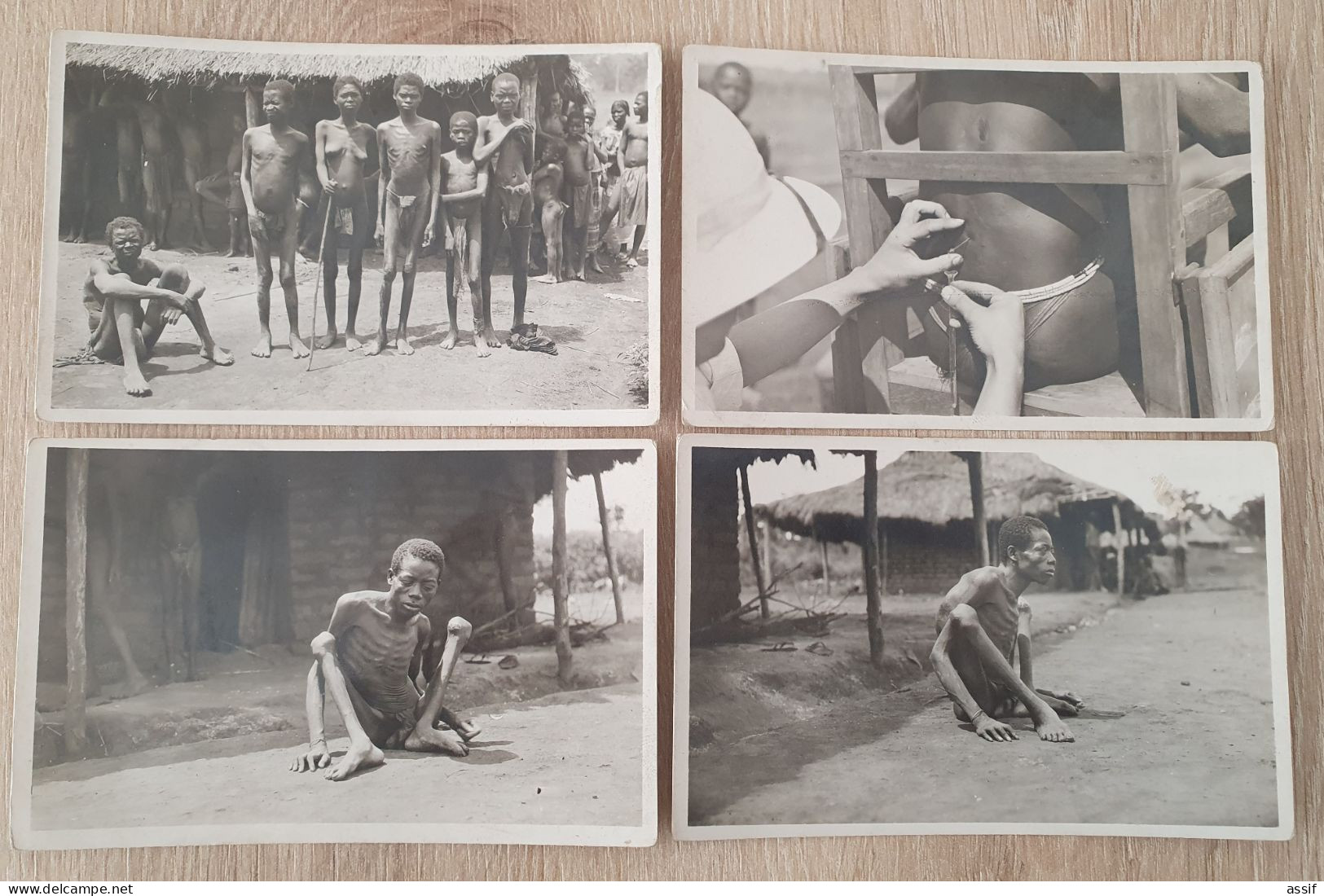 Oubangui-Chari Maladie Du Sommeil 4 Cpa Collection Ethnographique Vergiat - Non Classificati