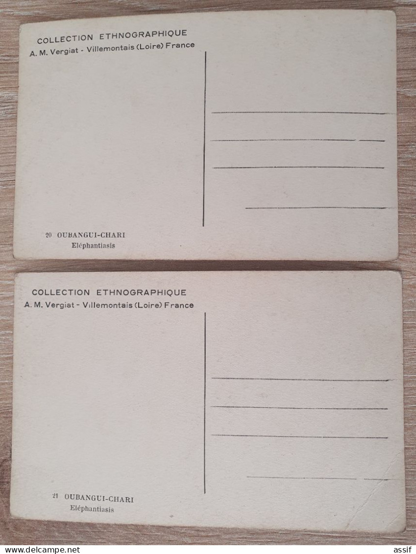 Oubangui-Chari éléphantiasis Elephantiasis 2 Cpa Collection Ethnographique Vergiat - Unclassified