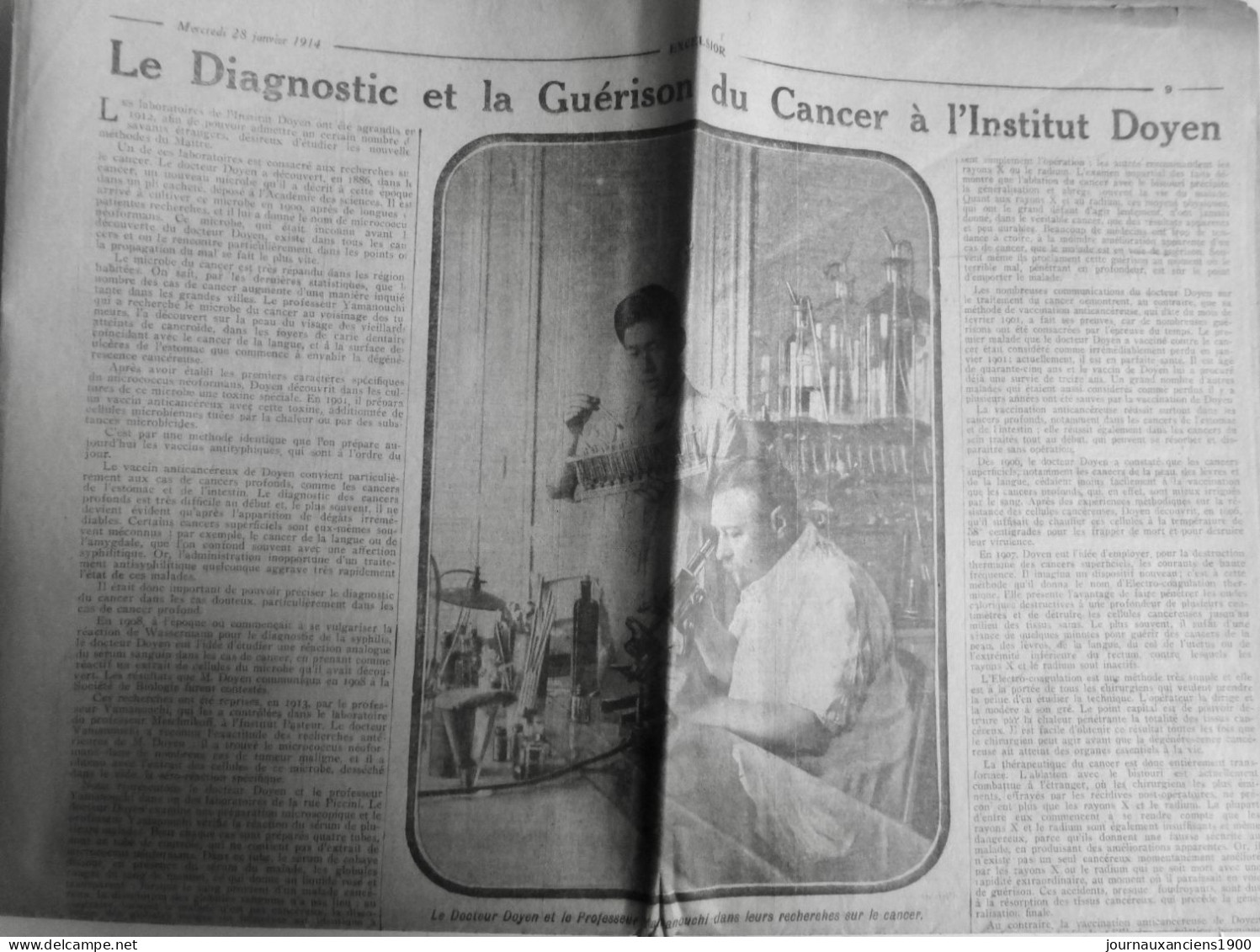 1914 EXCELSIOR ARTICLE DE PRESSE GUERISON CANCER INSTITUT DOYEN 1 JOURNAL ANCIEN - Glass Slides