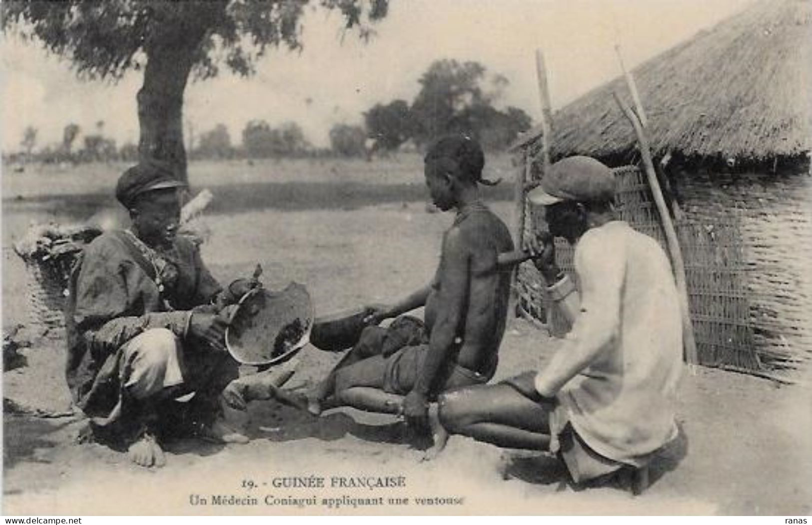 CPA Guinée Médecin Métier Non Circulé Ventouse - Guinea