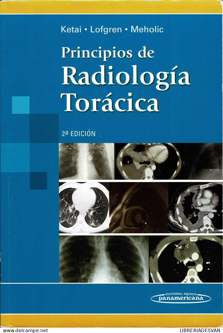 Principios De Radiología Torácica - Ketai, Lofgren, Meholic - Salud Y Belleza