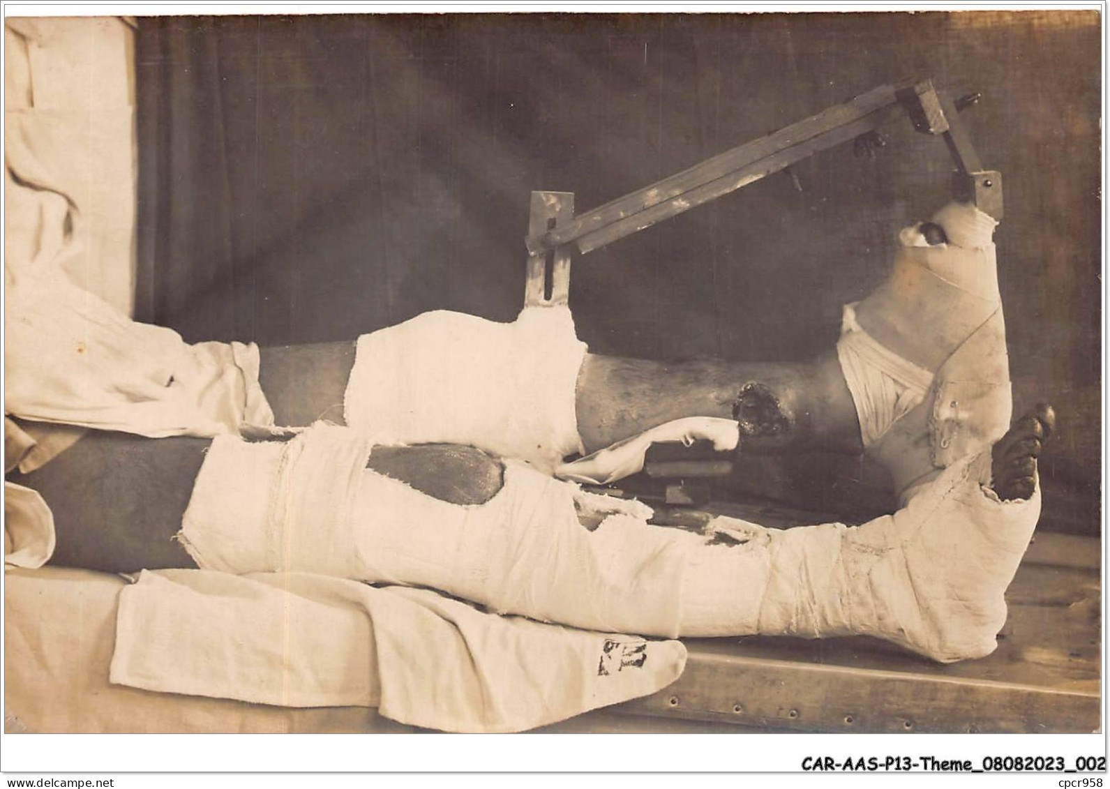 CAR-AASP13-0856 - SANTE - CARTE PHOTO - POILU.operation Chirurgie Medecine - Health