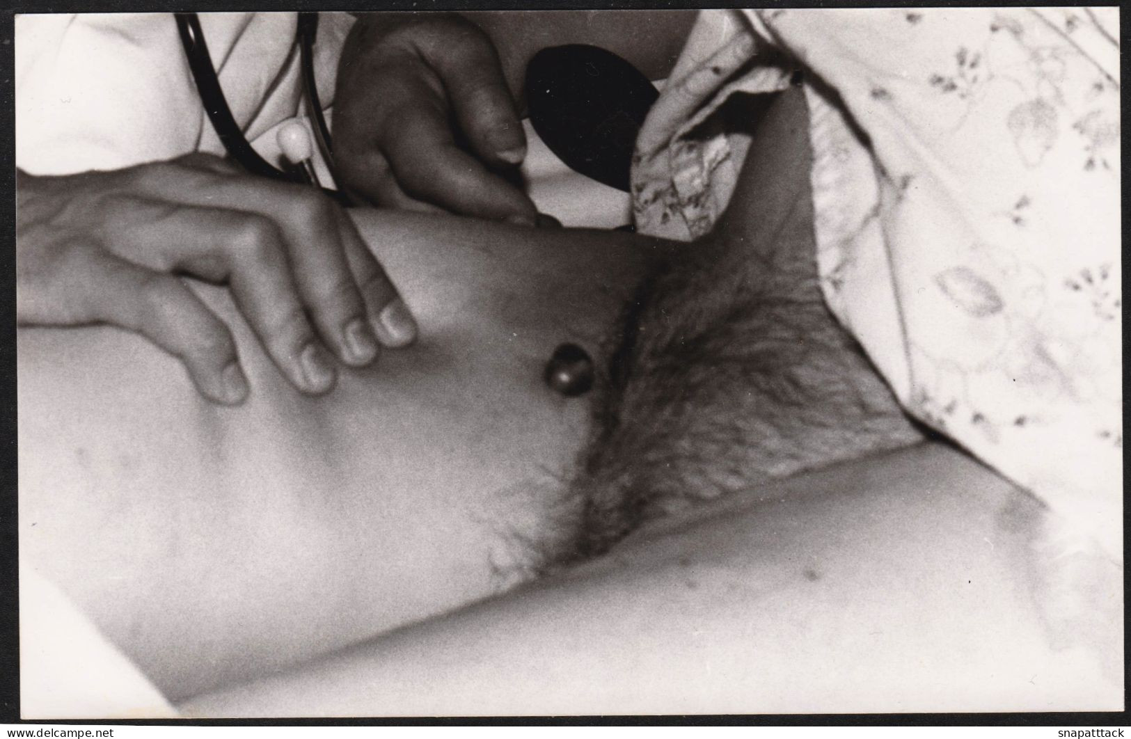 Photographie D'un Auscultation, Bouton Sur L'aine, Poils Pubiens, érotique, Sexy, Hot Nue Nu Nude Erotic Médecine 9x14cm - Unclassified