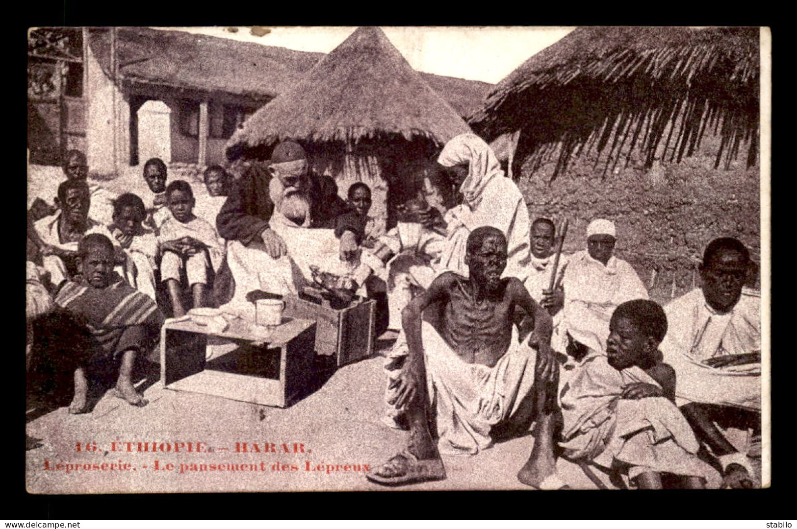 ETHIOPIE - HARAR - LEPROSERIE - LE PANSEMENT DES LEPREUX - Ethiopia