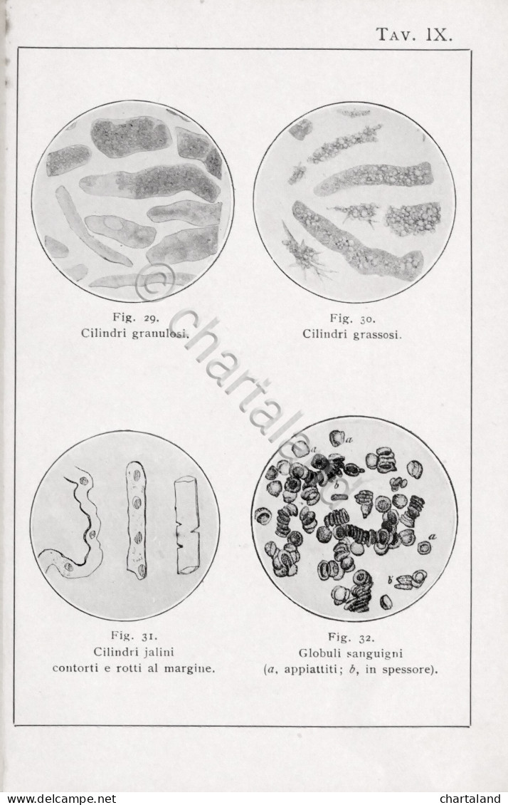 Manuali Hoepli - Dott. Giacomo Tellera - Analisi Urine - 1^ Ed. 1932 - Other & Unclassified