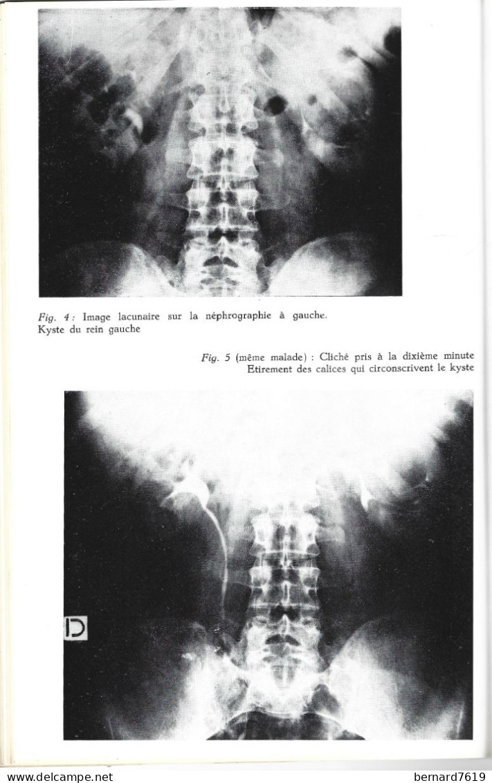 Livre - Essai D'urographieintra Veineuse Par Perfusion Reduite  Docteur  Jean Claude Grand Externe Des Hopitaux De Paris - Ciencia