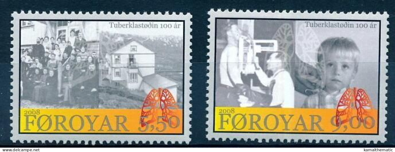 Faroe Islands 2008 MNH 2v, X Ray, Lungs, Medicine, Tuberculosis Sanatorium - Maladies