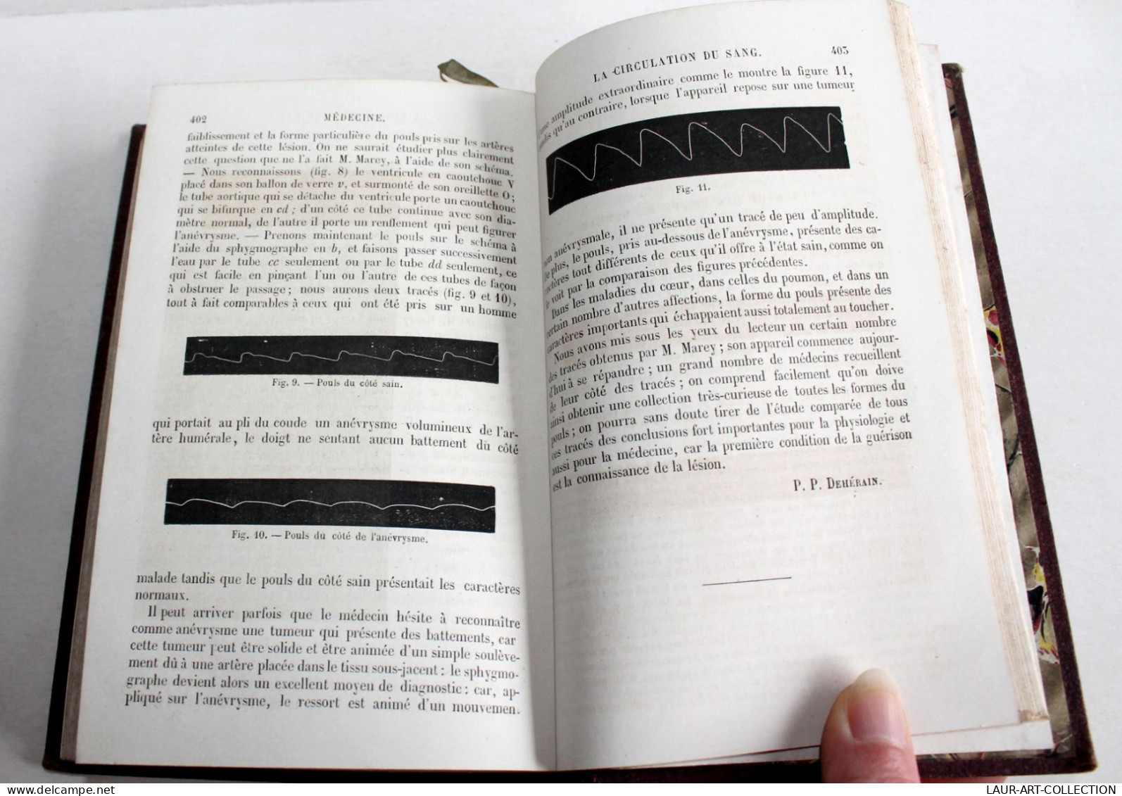 ANNUAIRE SCIENTIFIQUE De DEHERAIN 4e ANNEE 1865 CHARPENTIER PROGRES DES SCIENCES / ANCIEN LIVRE XIXe SIECLE (2603.48) - Santé