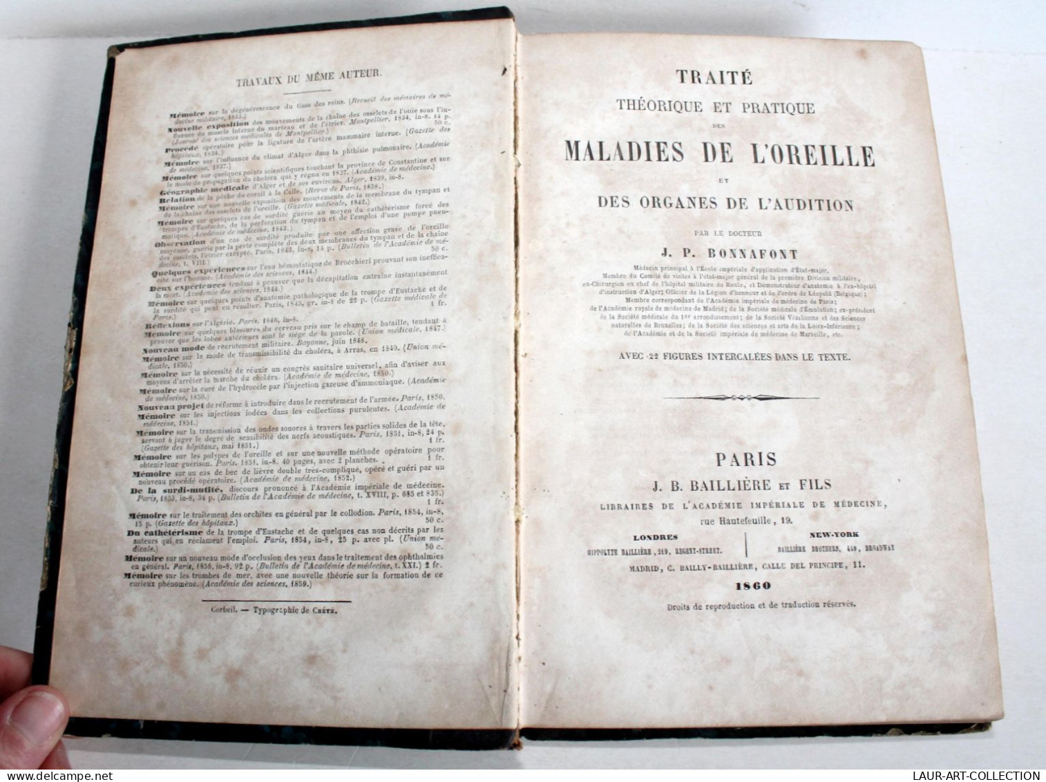 TRAITE THEORIQUE & PRATIQUE DES MALADIES DE L'OREILLE & ORGANES AUDITION 1860 EO / ANCIEN LIVRE XIXe SIECLE (2603.89) - Gezondheid