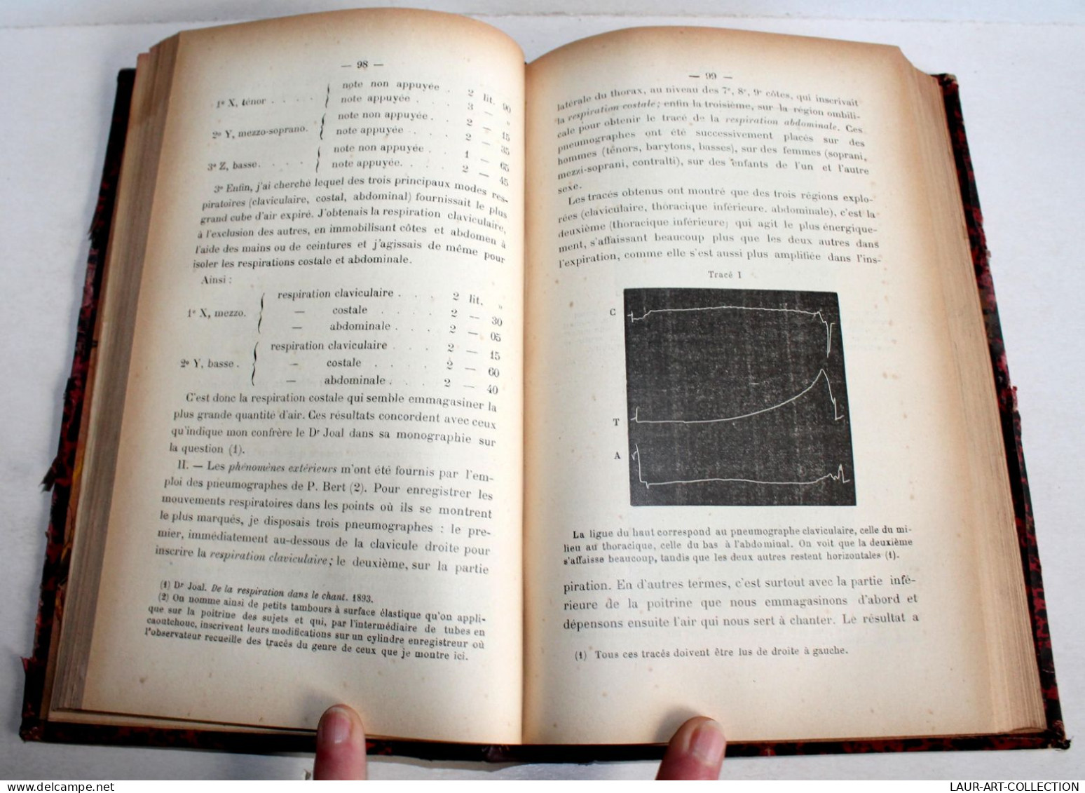 LA VOIX, PARLEE & CHANTEE ANATOMIE PHYSIOLOGIE PATHOLOGIE HYGIENE EDUCATION 1895 / ANCIEN LIVRE XXe SIECLE (2603.97) - Health