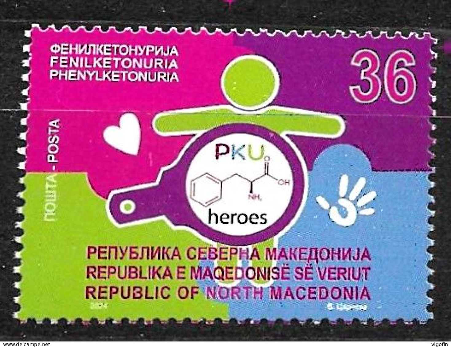 NMK 2024-02 CHILDREAN WHIT RARE DISEASES, NORTH MACEDONIA, 1v, MNH - Macedonia Del Norte