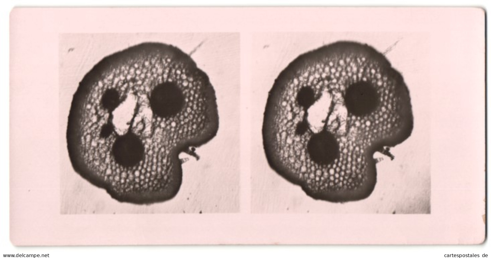 Stereo-Fotografie Makroaufnahme, Mikroskopische Vergrösserung, Medizin, Biologie  - Photos Stéréoscopiques