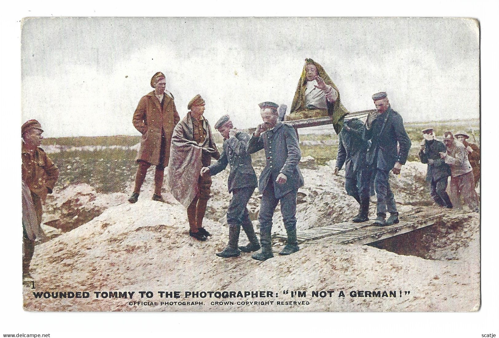 London  -    Wounded  Tommy To The Photographer:  "I'm Not A German!"   -   1914-1916 - Weltkrieg 1914-18