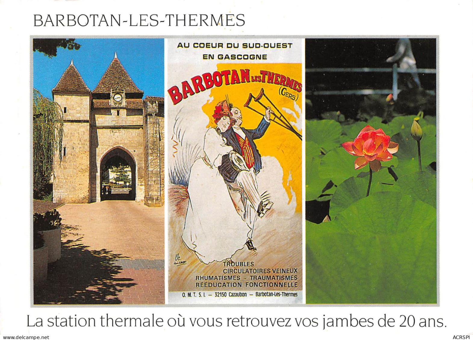 BARBOTAN LES THERMES LA Station Thermale Ou Vous Retrouverez Vos Jambes De 20 Ans 18(scan Recto-verso) MA2085 - Barbotan