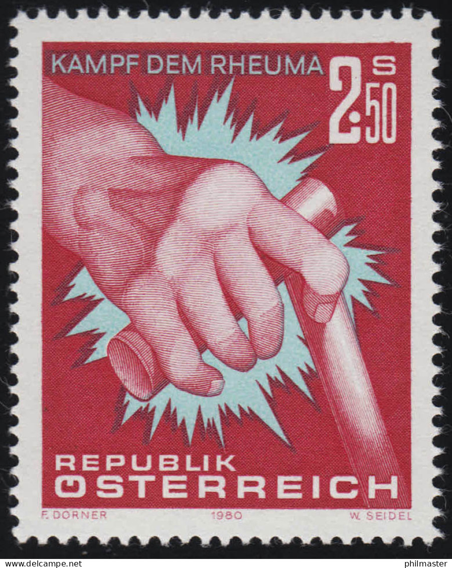 1632 Kampf Dem Rheuma, Hand Einer Rheumakranken, 2.50 S, Postfrisch ** - Ungebraucht