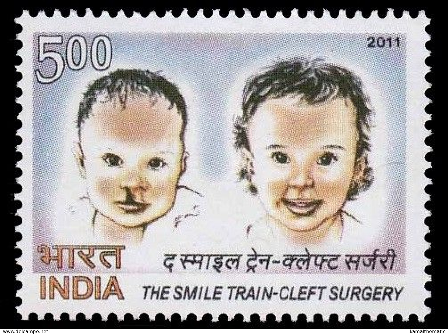 India 2011 MNH, Medicine, Health, Surgery, The Smile Train - Krankheiten