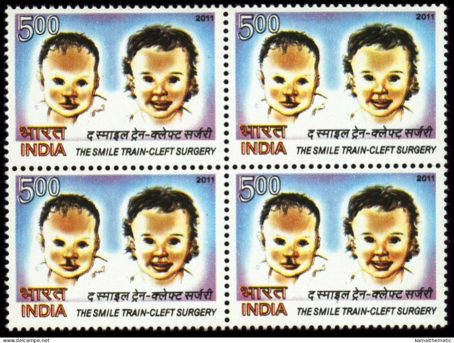 India 2011 MNH BLk 4, Medicine, Surgery, Smile Train - Enfermedades