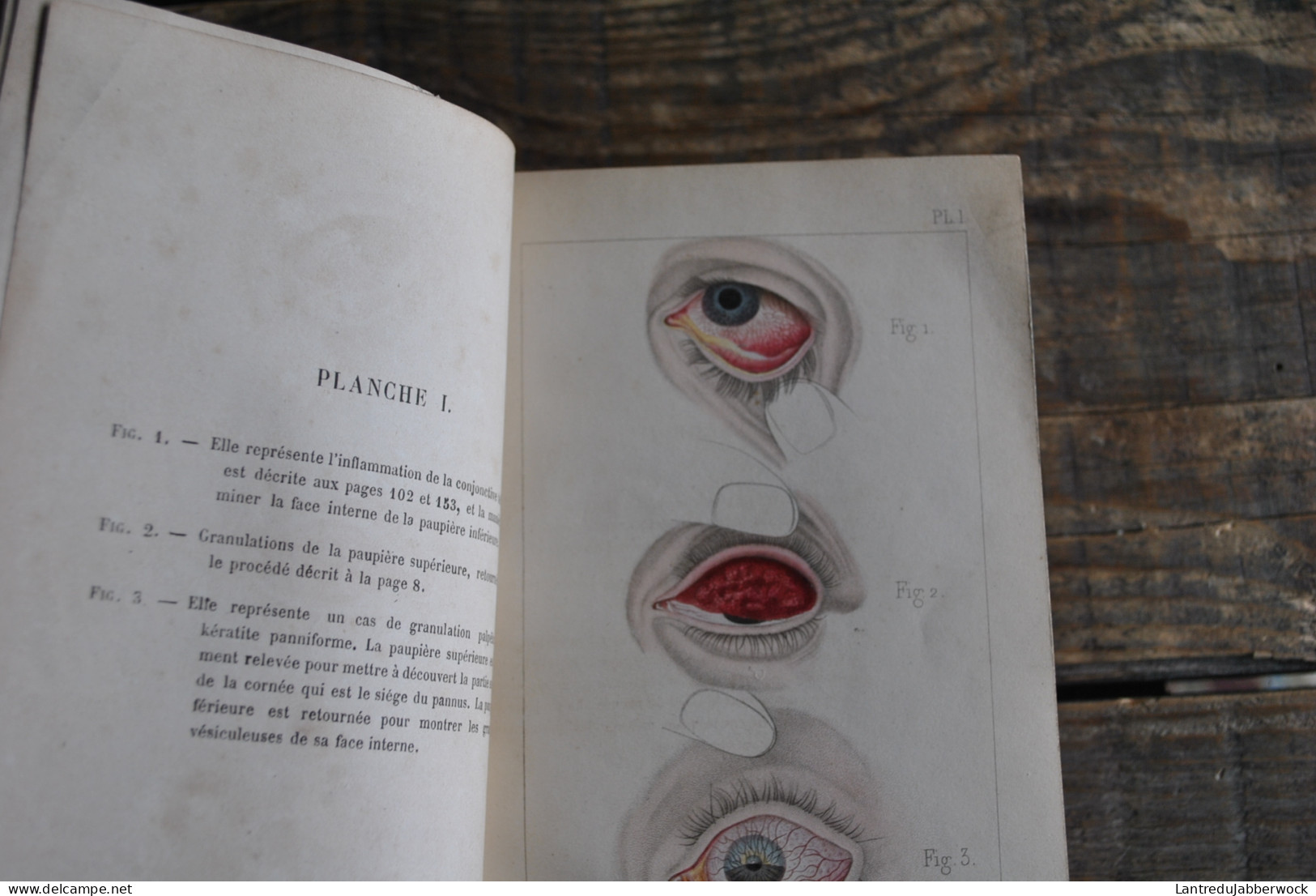 Wharton-Jones TRAITÉ PRATIQUE DES MALADIES DES YEUX Editions Chamerot 1862 + Planches Couleurs Médecine Chirurigie XIXè - 1801-1900