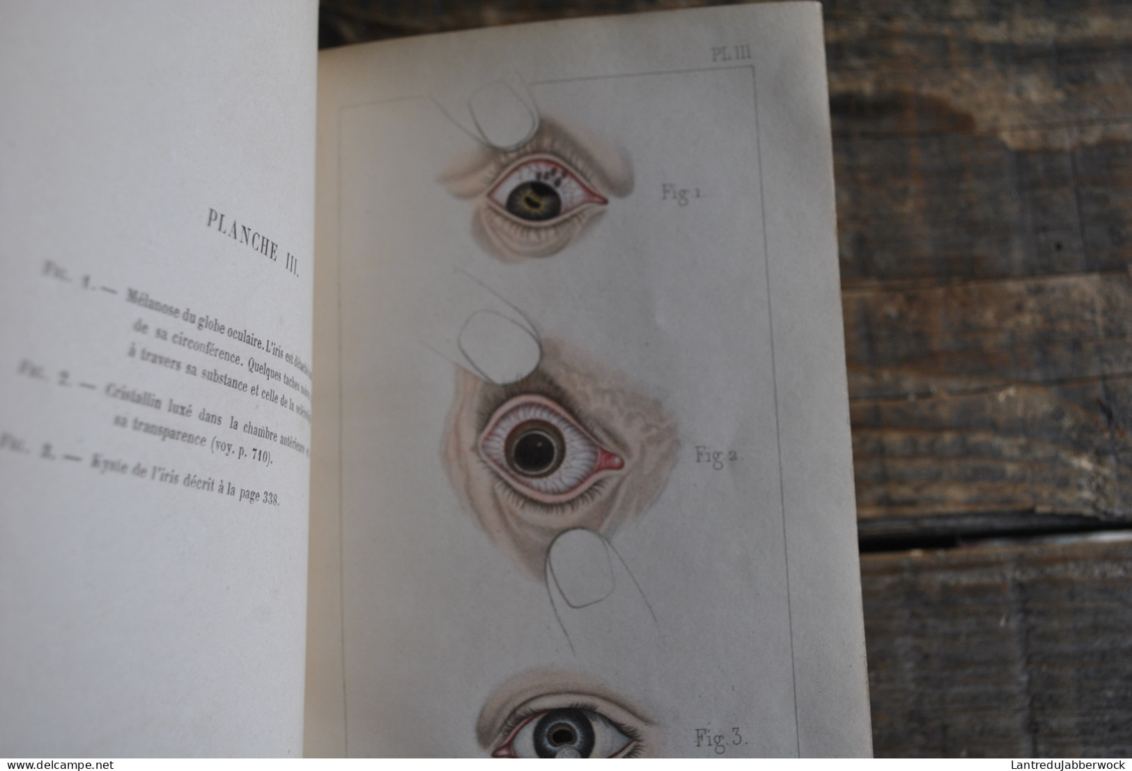 Wharton-Jones TRAITÉ PRATIQUE DES MALADIES DES YEUX Editions Chamerot 1862 + Planches couleurs Médecine chirurigie XIXè