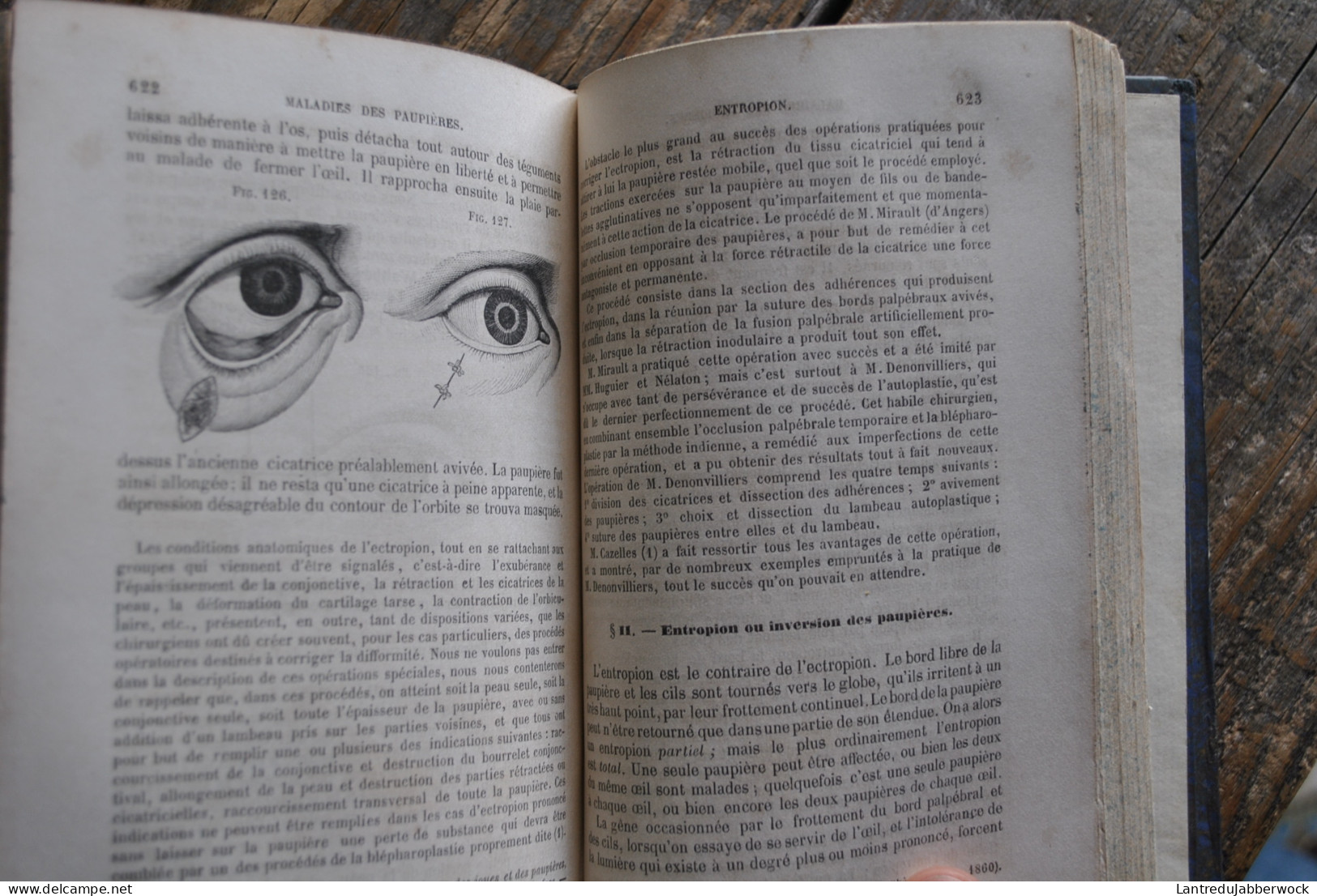 Wharton-Jones TRAITÉ PRATIQUE DES MALADIES DES YEUX Editions Chamerot 1862 + Planches couleurs Médecine chirurigie XIXè