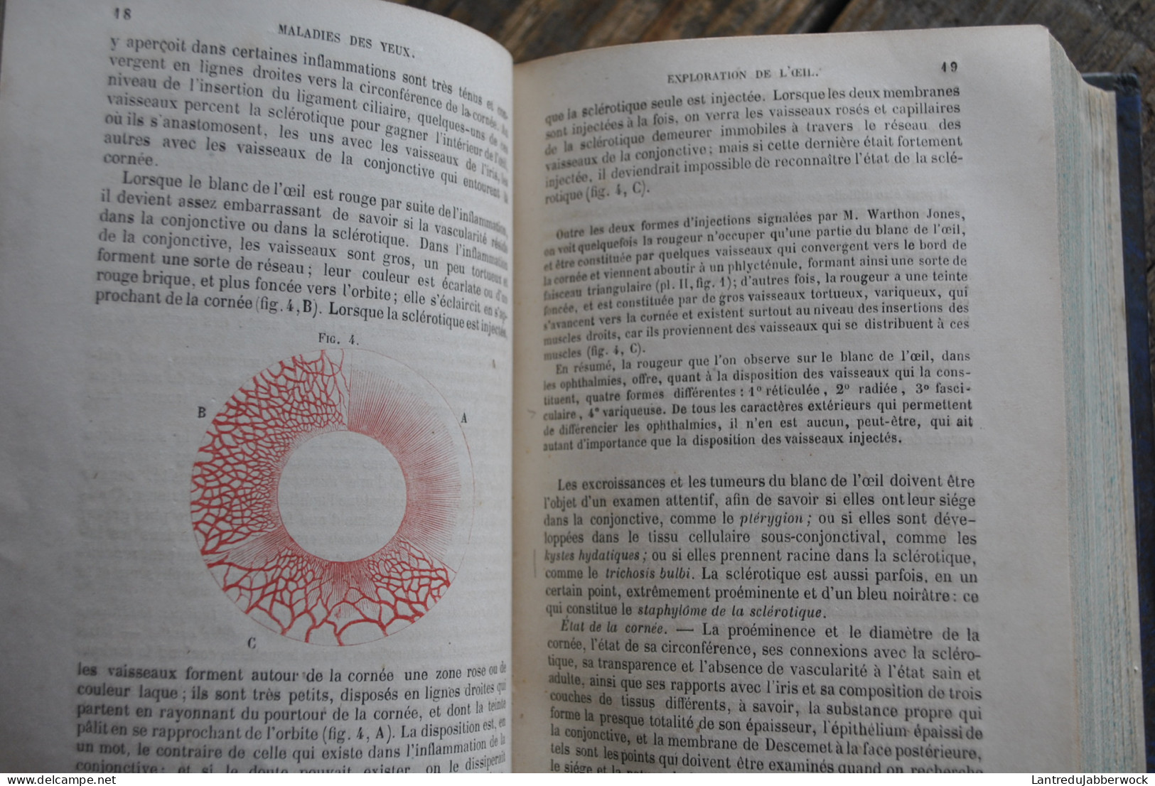 Wharton-Jones TRAITÉ PRATIQUE DES MALADIES DES YEUX Editions Chamerot 1862 + Planches couleurs Médecine chirurigie XIXè