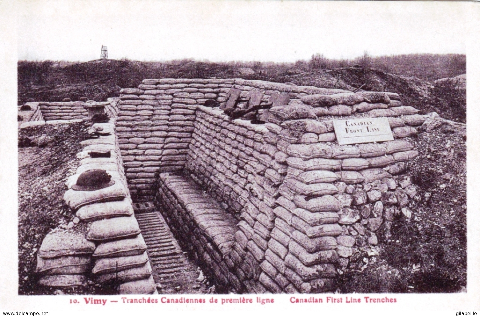 62 - Pas De Calais -  VIMY -  Tranchée Canadienne De Premiere Ligne - Guerre 1914 - Autres & Non Classés