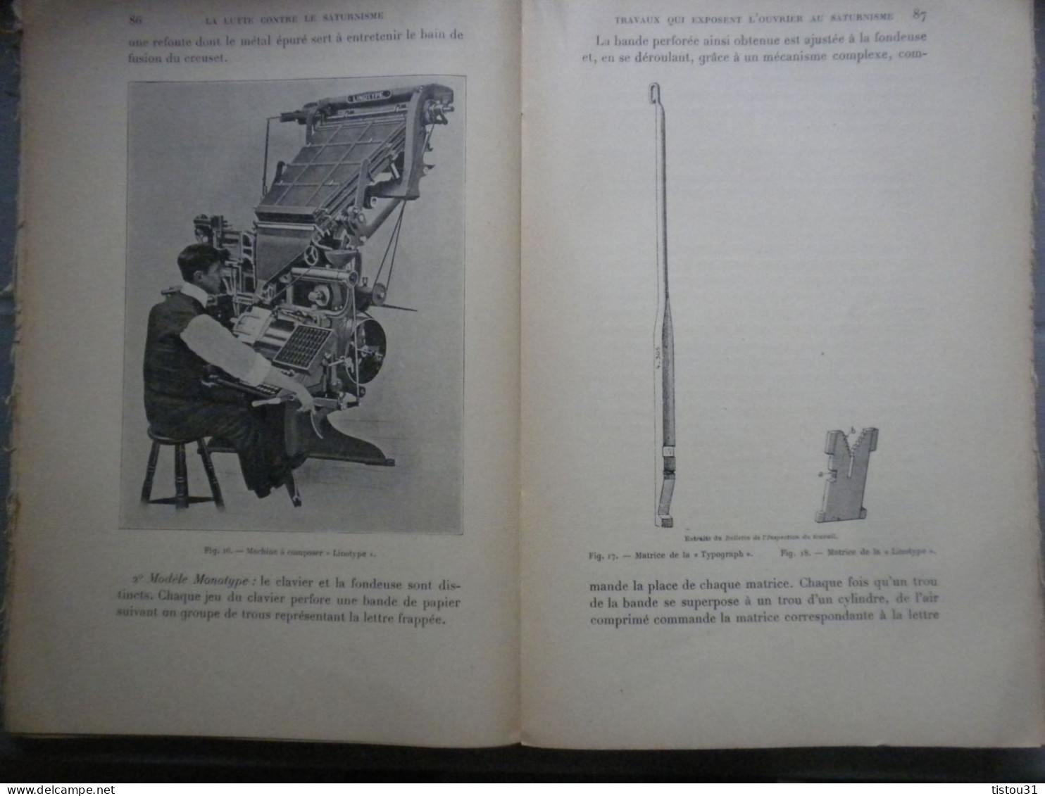 La Lutte Contre Le Saturnisme (empoisonnment Par Le Plomb), 1912 - Ciencia