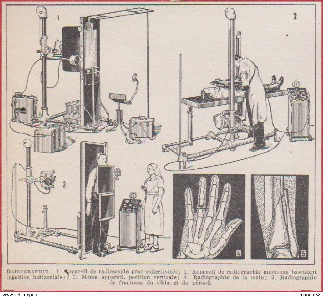 Radiographie. Divers Appareils. Larousse 1948. - Historische Documenten