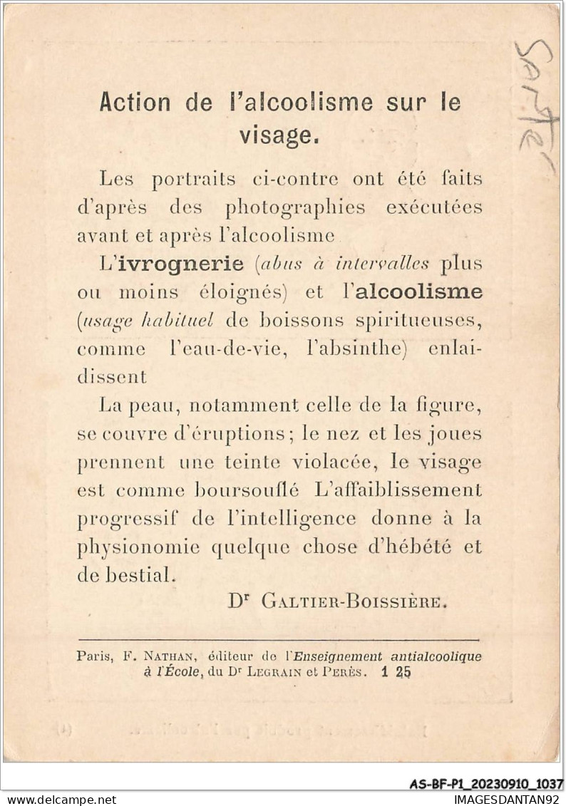 AS#BFP1-0519 - SANTE - Enlaidissement Produit Par L'alcoolisme - Health